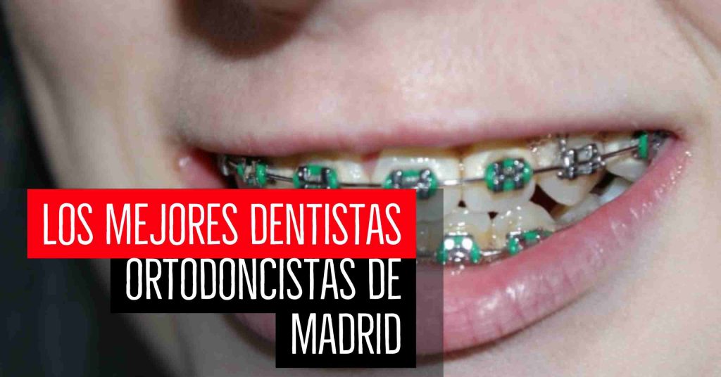 Los mejores dentistas ortodoncistas de Madrid