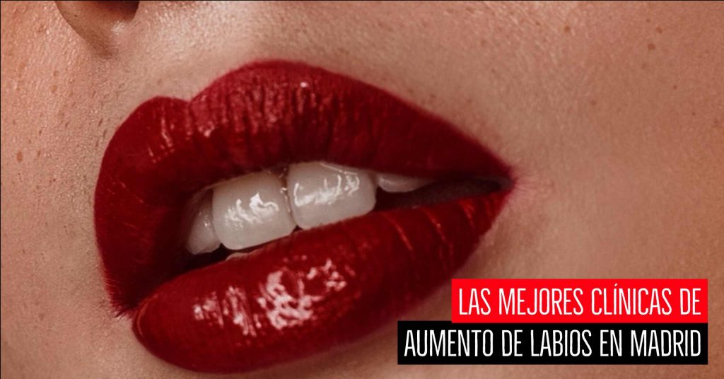 Mejores Clínicas de aumento de labios en Madrid
